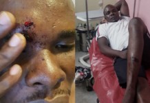 Popular Bayelsa blogger escapes death as suspected militants invade his home, beat him black and blue