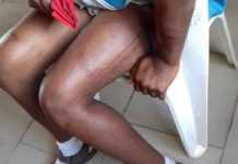 EXCLUSIVE!! Woman on the Run After Beaten School Girl to Pulp for Resisting Rape (Graphic Photos)