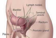 REMEDY APPROACH FOR SEXUAL WEAKNESS … What 70% of Men Experiencing especially when Married